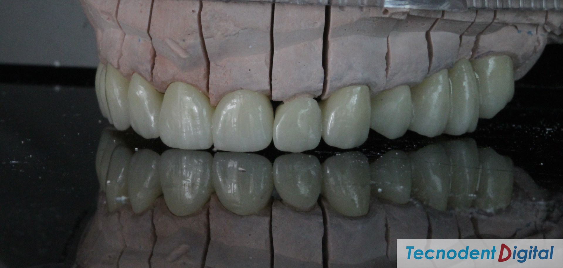 Centro-de-Fresado-Gandia-Laboratorio-Dental-odontologia-estetica