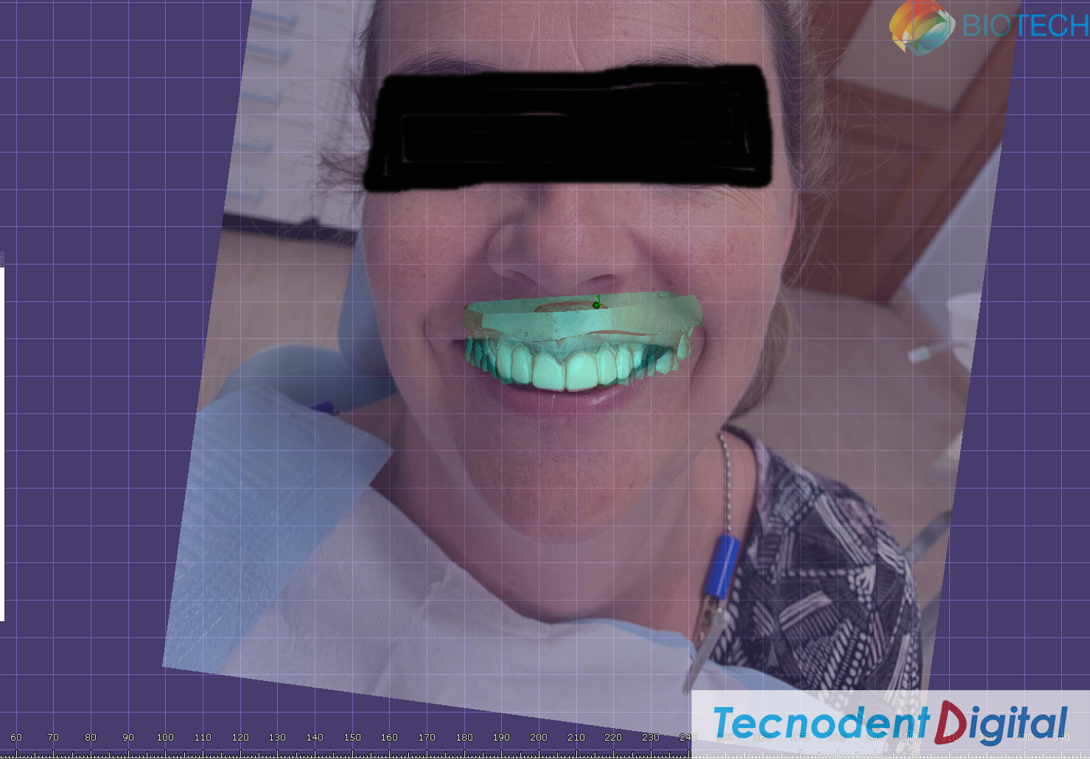 Centro-de-Fresado-Gandia-Laboratorio-Dental-odontologia-estetica