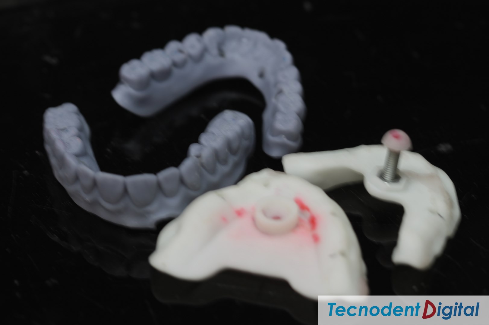 Rehabilitacion Implantes Arco gotico laboratorio Dental Gandia Estetica Dental