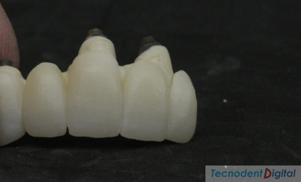 Zirconio fundido sobre metal